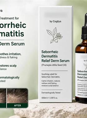 Seborrheic Dermatitis Relief Derm Serum 头皮植萃舒适精华