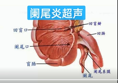 超声笔记阑尾炎超声阑尾炎诊断医学超声诊断影像学电子版