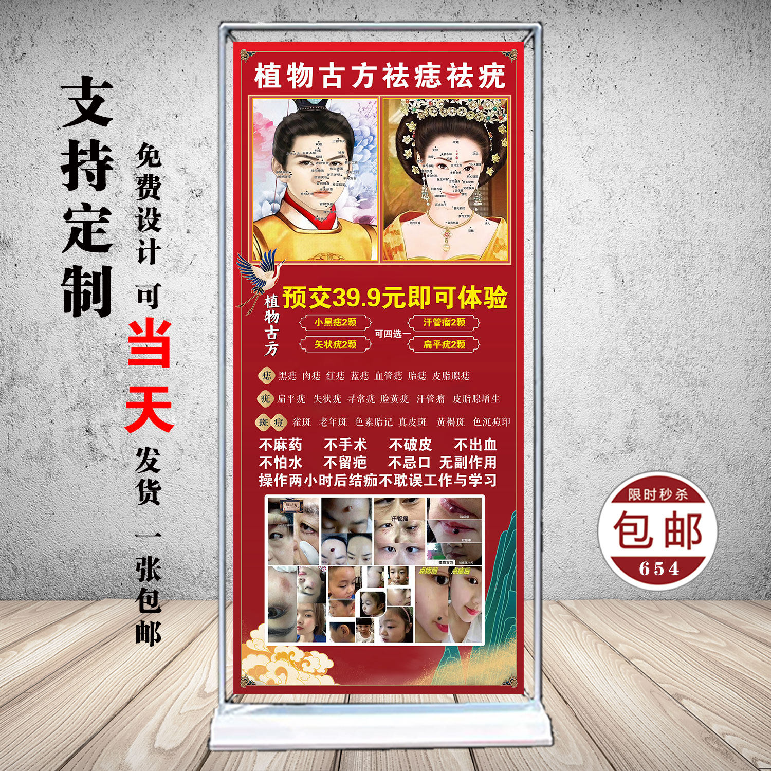 祛斑点痣净痣净斑室内活动宣传户外防水展架高清海报写真广告定制