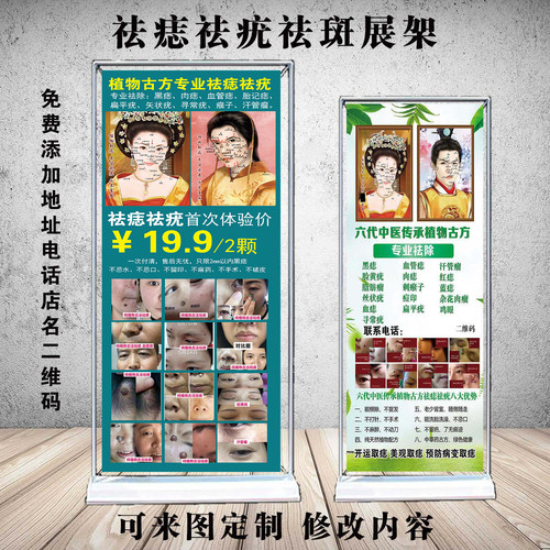门型展架写真易拉宝点痣祛疣祛斑
