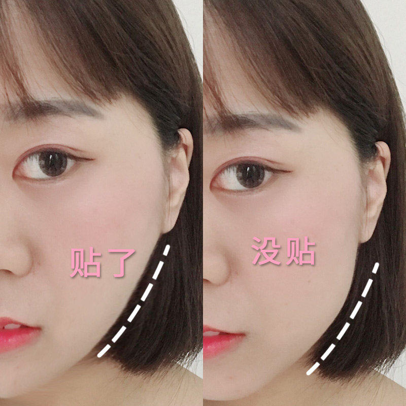 韩国瘦脸贴脸部下垂提拉贴