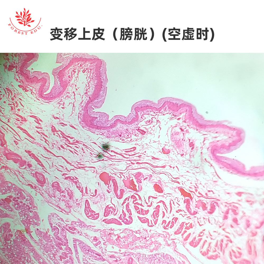 人输尿管横切变移上皮膀胱空虚时扩张时人体泌尿系统组织显微玻片