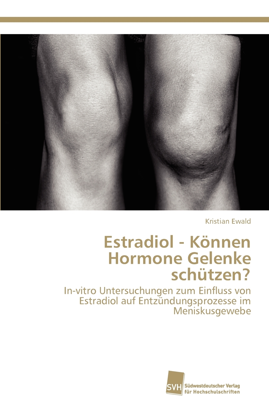 预售按需印刷 Estradiol- K?nnen Hormone Gelenke schützen?德语ger
