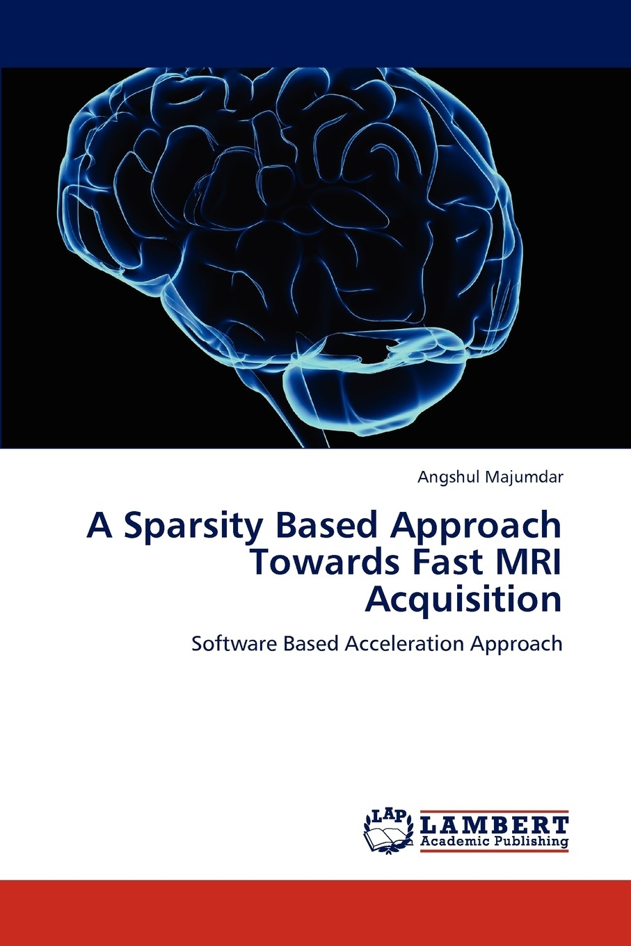 预售 按需印刷a sparsity based approach towards fast mri