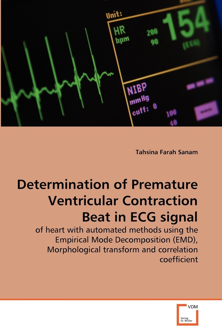 预售 按需印刷determination of premature ventricular contraction