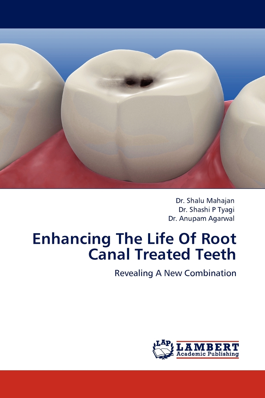 【预售 按需印刷】enhancing the life of root canal treated teeth