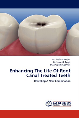 【预售 按需印刷】Enhancing The Life Of Root Canal Treated Teeth