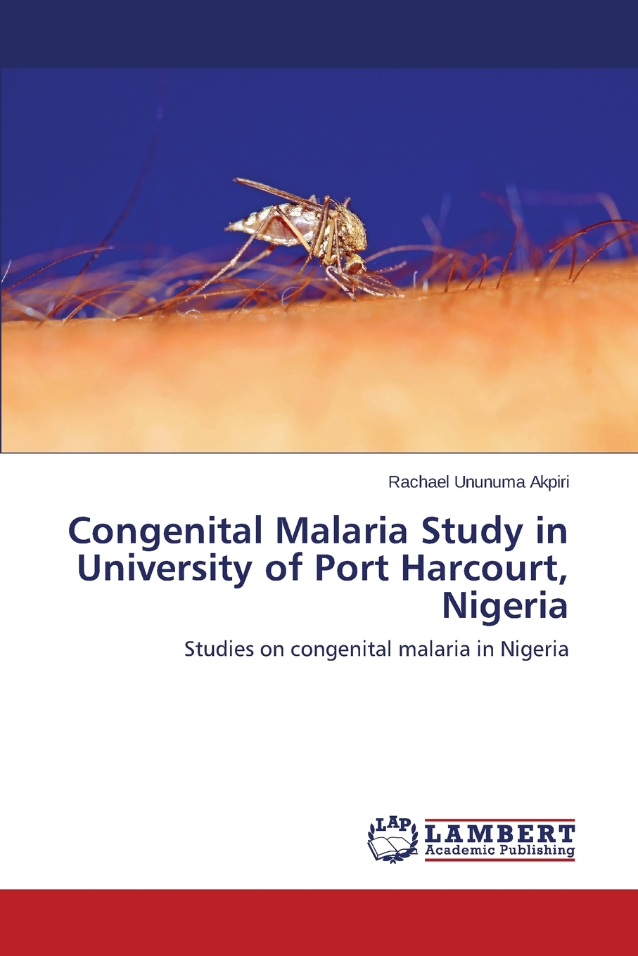 预售按需印刷 Congenital Malaria Study in University of Port Harcourt Nigeria