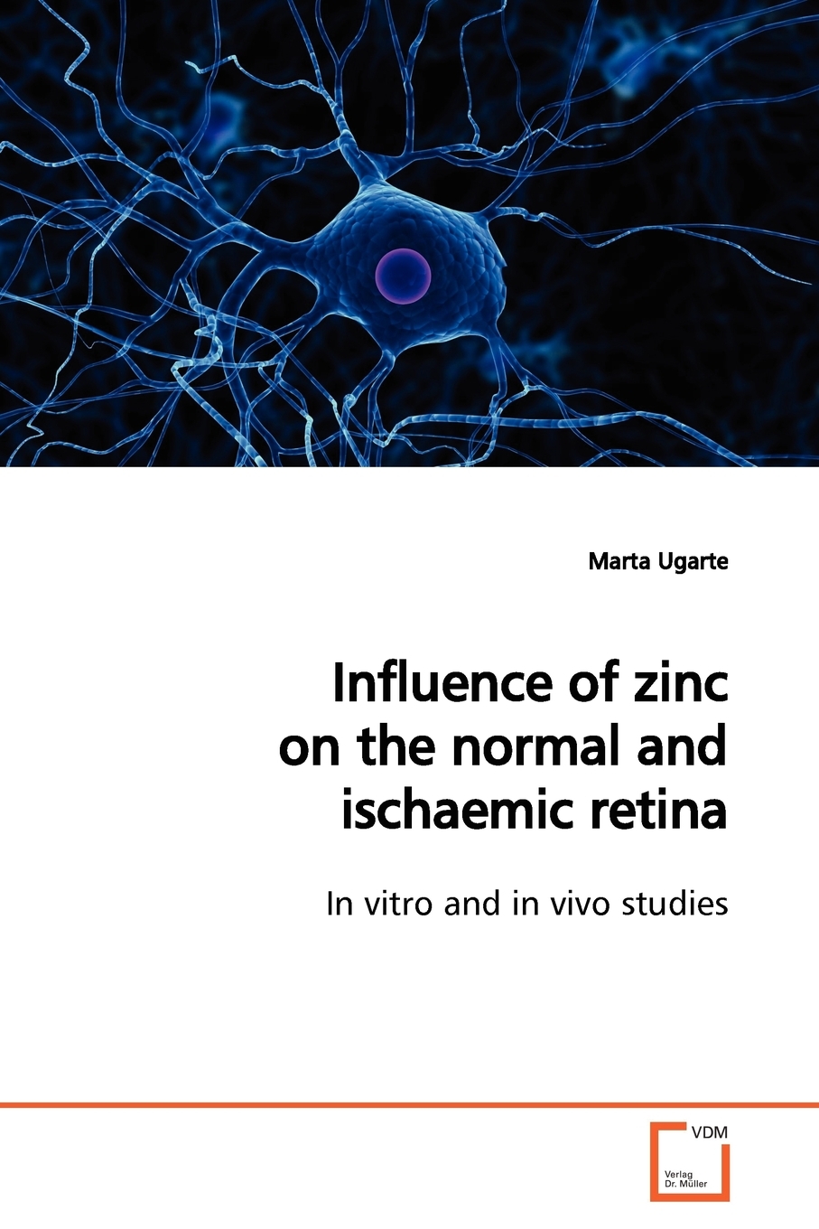 【预售按需印刷】Influence of zinc on the normal and ischaemic retina