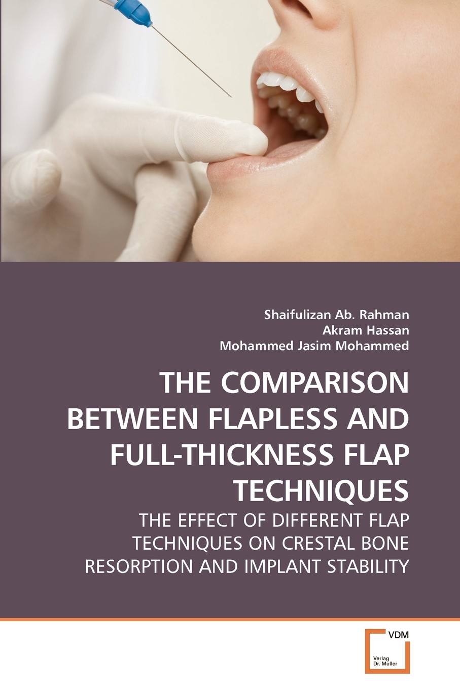 【预售 按需印刷】the comparison between flapless and