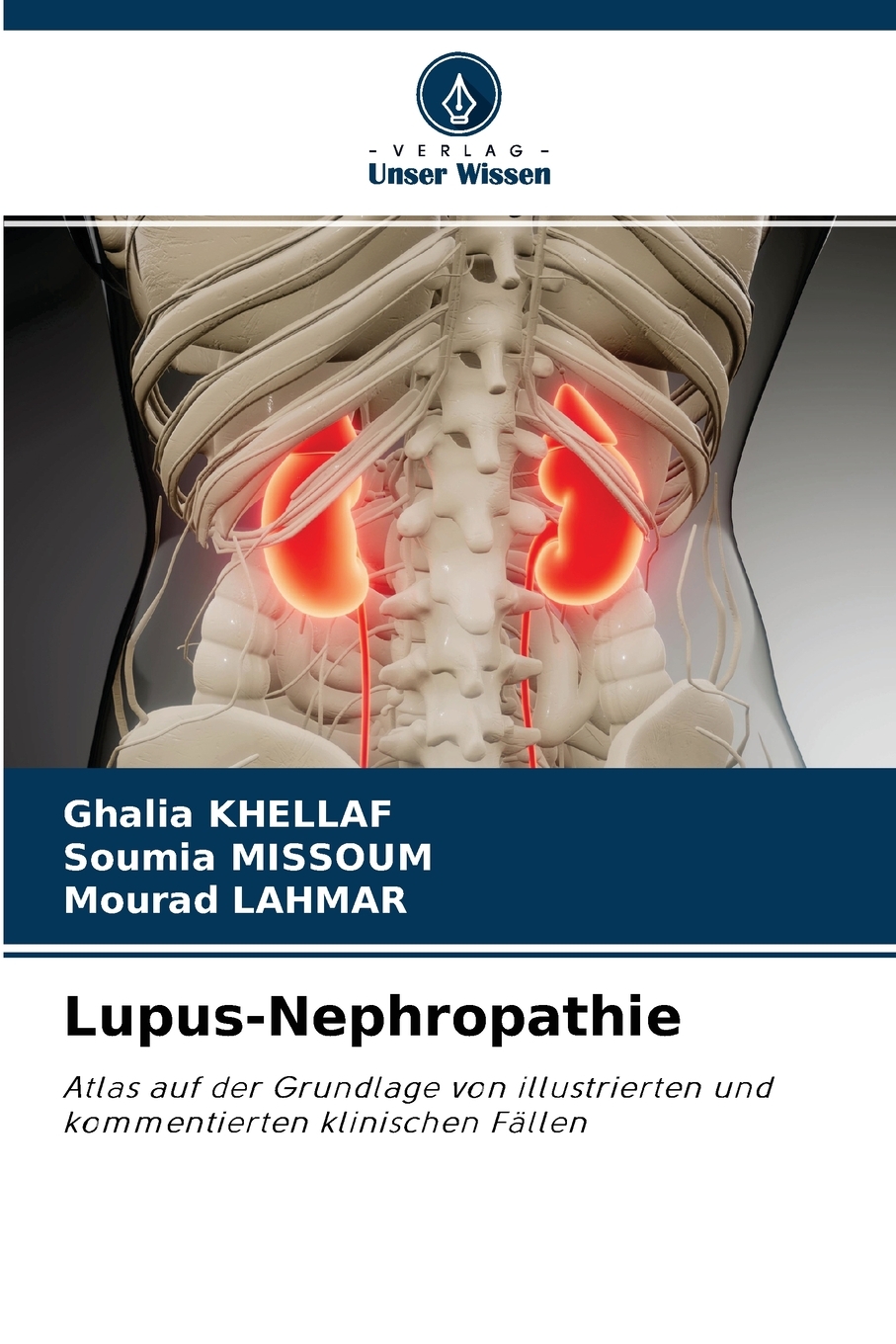 预售按需印刷Lupus-Nephropathie德语ger