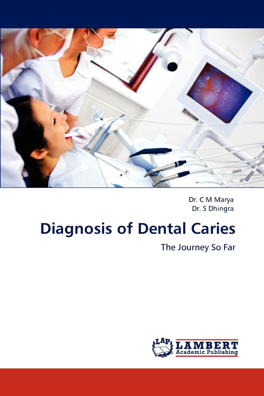 预售 按需印刷 diagnosis of dental caries