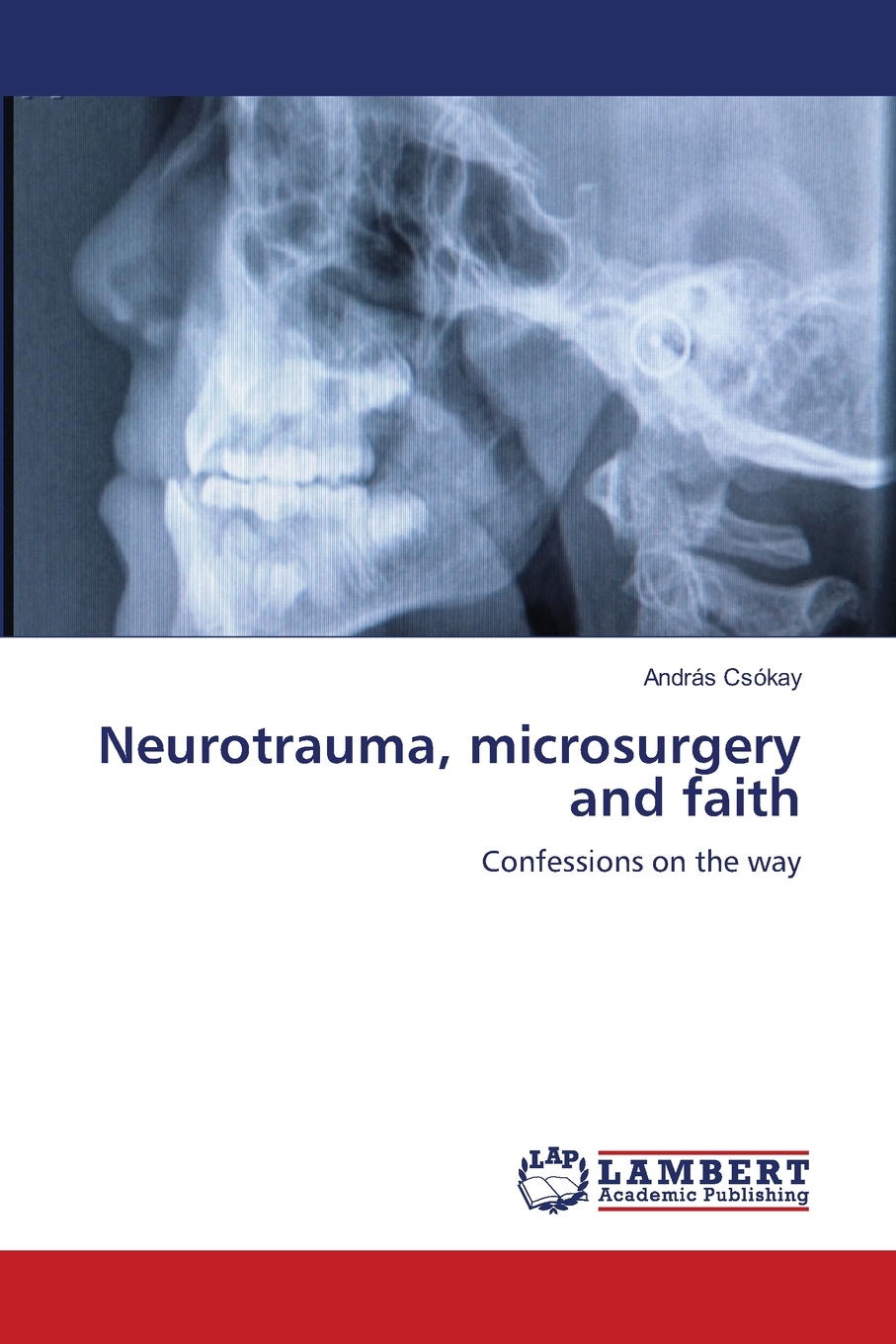 预售 按需印刷 Neurotrauma  microsurgery and faith 书籍/杂志/报纸 原版其它 原图主图