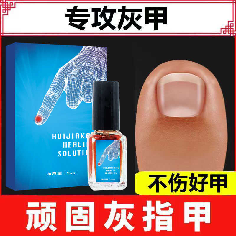 甲姿迪治去亮甲灰指甲专用不刺激增厚甲沟焱正品生物修护膜抑菌液