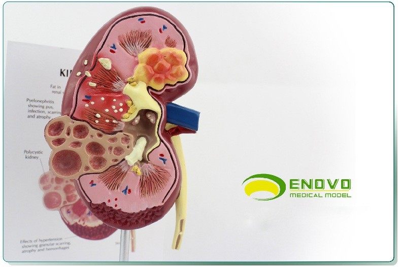 ENOVO颐诺人体肾脏解剖模型