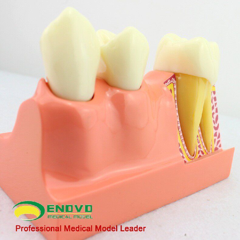 enovo颐诺牙体分解模型牙齿解剖模型口腔科教学牙体解剖形态模型