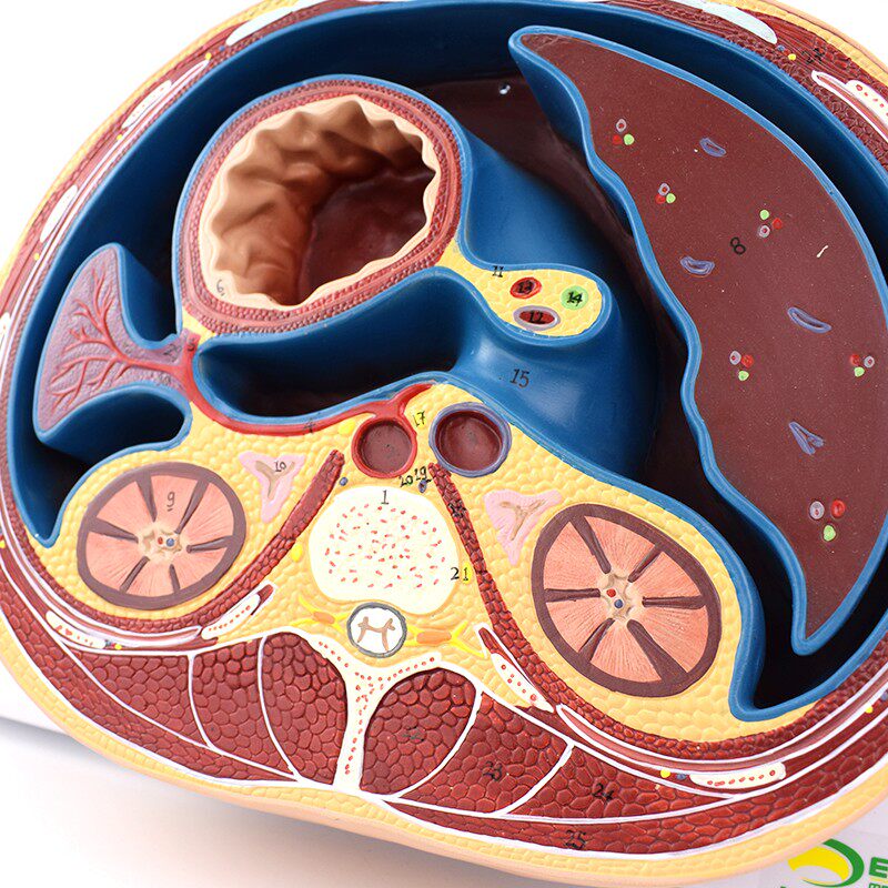 enovo颐诺人体腹部断面模型平网膜网膜囊孔结构解剖标本ctmri