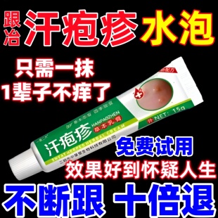 汗疱泡疹止去痒根专用膏药手上起小水泡抑菌鹅掌风真菌感染湿痒疹
