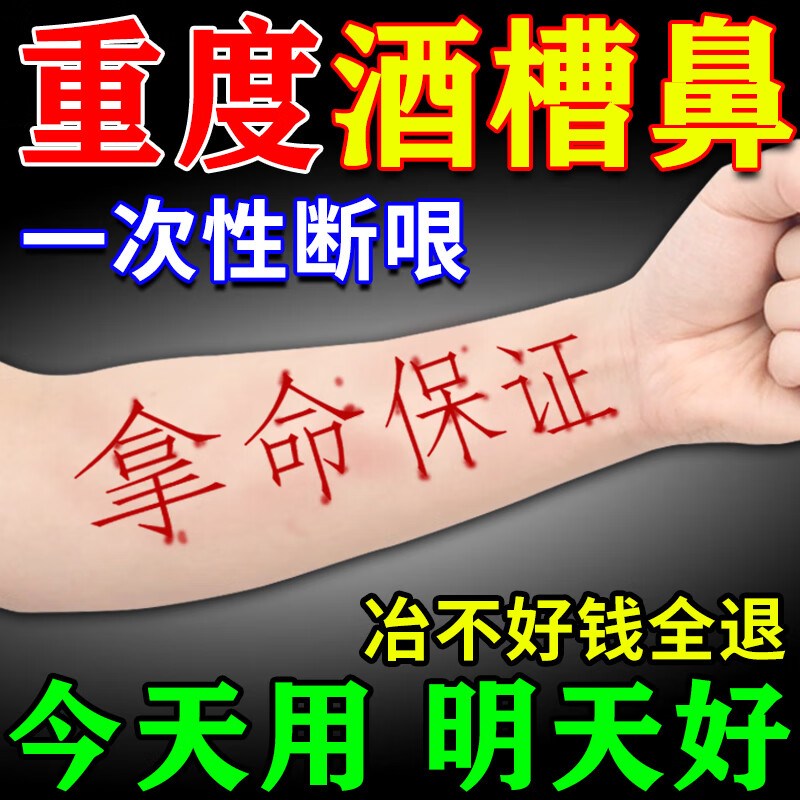 【酒糟鼻专用】酒糟鼻修复软膏草莓鼻玫瑰座疮鼻头红血丝红肿抑菌