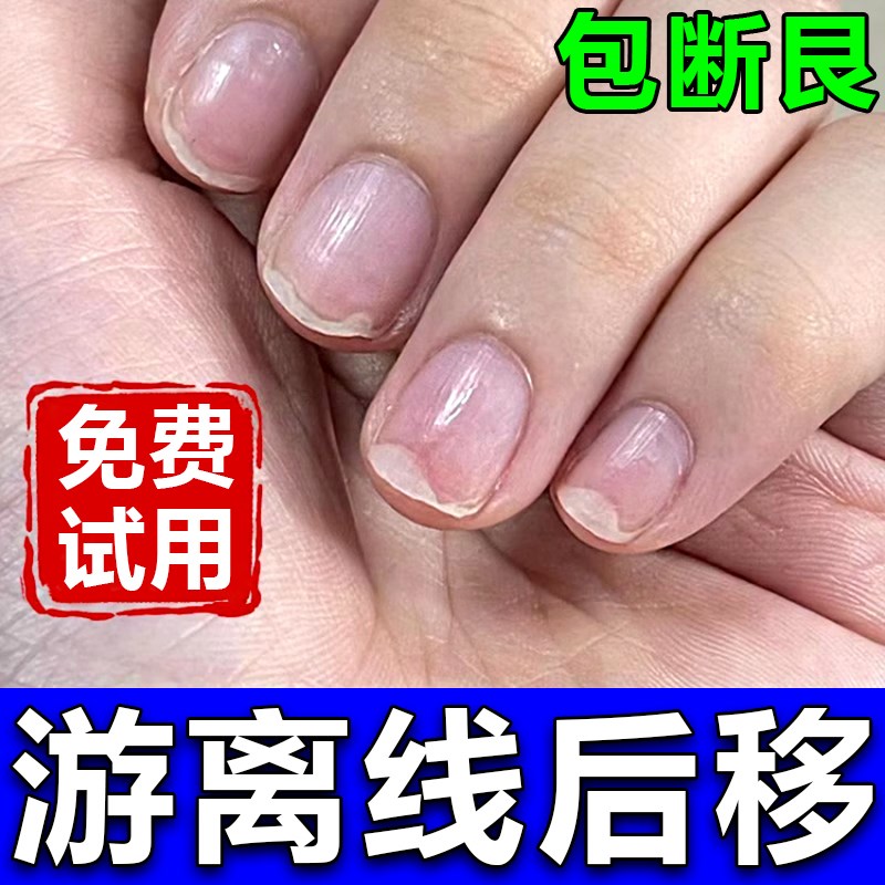 指甲游离线生长液护甲油萎缩增长液延长营养油养甲床分离空甲修复