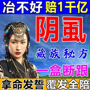 旗舰店治疗男女专用特效药虱立净百部酊灭阴虱喷剂 阴虱一扫光正品