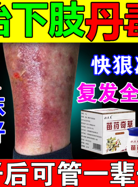 丹毒专药用膏【快狠准】冶疗下肢畏寒肿胀红疼痛灼热流火专用软膏