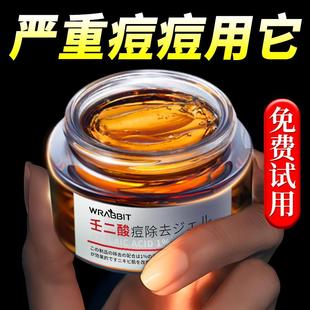 壬二酸祛痘药膏祛痘印修复淡化消印正品男女学生去青春痘痘坑消炎