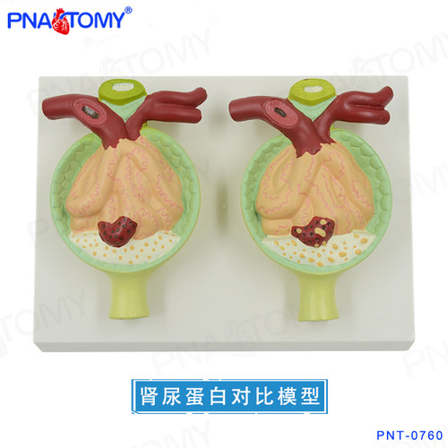 尿蛋白模型肾小球教具PNATOMY