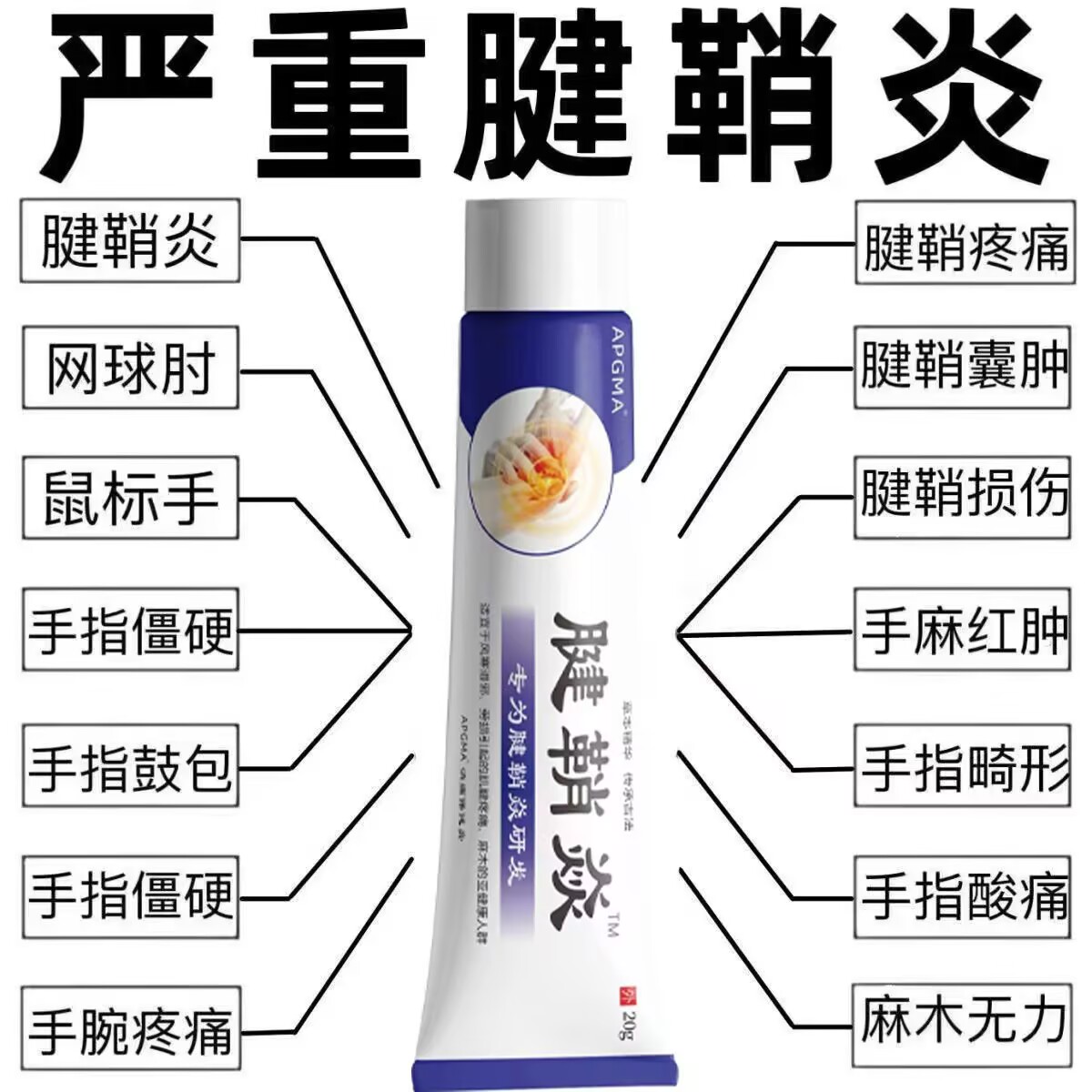腱鞘炎手指手腕关节痛劳损扭伤筋骨疼痛凝胶僵直麻木弹响鼓包消肿