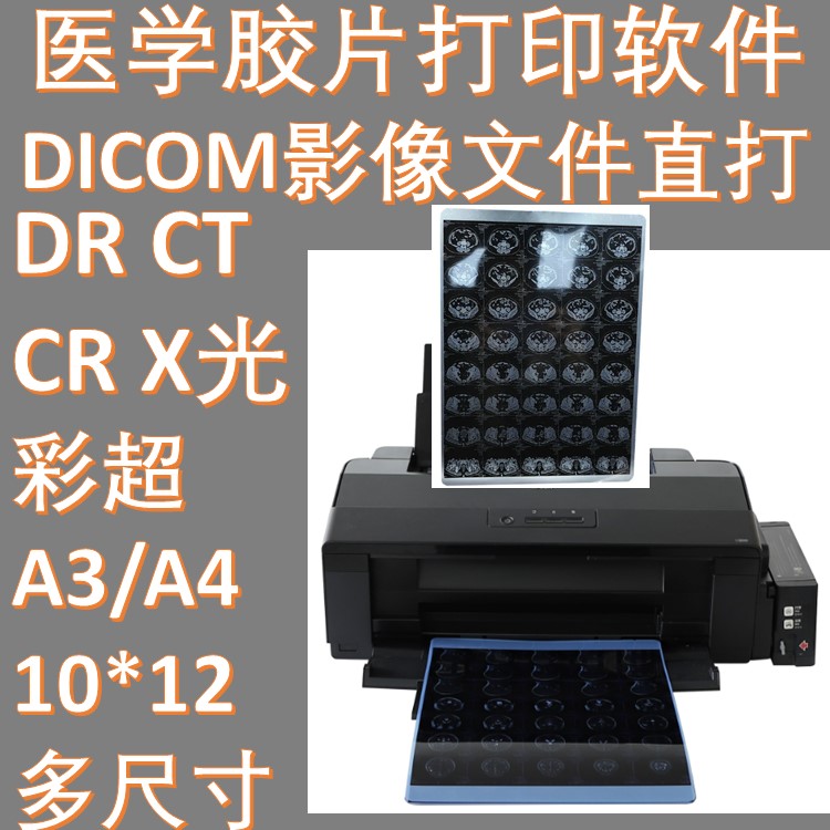 DICOM打印服务器软件DCM PrintSCP 胶片喷墨注册不限张数
