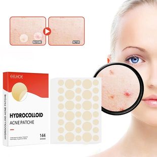 144pcs/set Face Skin Care Acne Pimple Patch 2 Sizes Invisibl