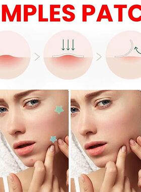 200pcs Star Acne Pimple Patches Colorful Breathable Removal