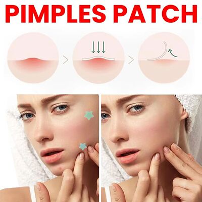 200pcs Star Acne Pimple Patches Colorful Breathable Removal