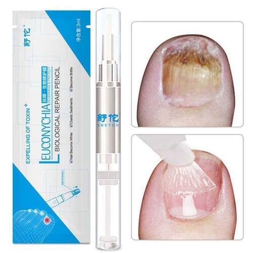 1pc Nail Fungal Treatment Pen Anti Fungus Infection Biologic