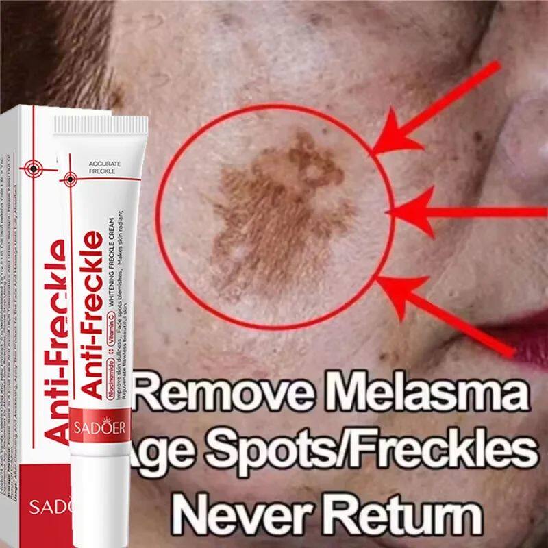 Powerful Whitening Freckles Face Cream Dark Spot Corrector R