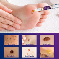 Skin Tag Remover Agat Moles 12 Hours Fast Removal Genital Wa thumbnail 5