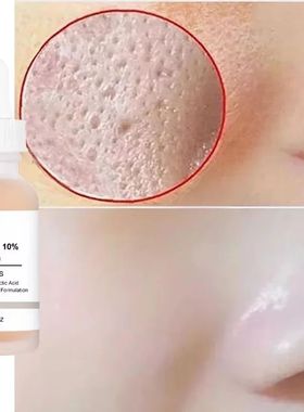 Remove Large Pores Serum Lactic Acid Facial Pore Shrinking R