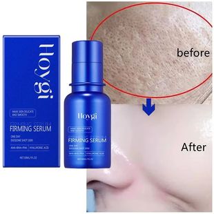 Essence Pores Facial Lifti Whitening Microneedle Blue Shrink