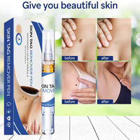 Skin Tag Remover Agat Moles 12 Hours Fast Removal Genital Wa thumbnail 6
