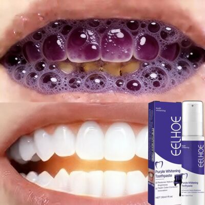 2026 Bestselling Whitening Toothpaste: Say Goodbye to Yellow