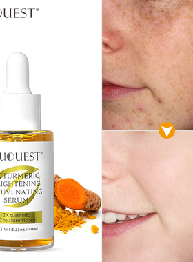 Dark Spot Remover Facial Serum Whitening Vitamin C Turmeric