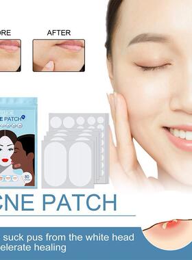 80pcs/set Acne Patches Large Size Hydrocolloid Acne Invisibl