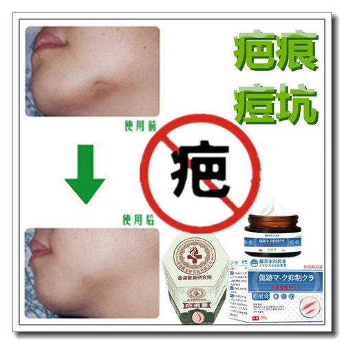 祛增生修复疙瘩性突起缝针开眼角伤疤痕印激光手术抓伤色素沉着疤