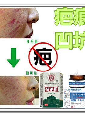 植物膏去除黑色素沉淀沉着淡化抓痕黑印红色素印祛男女修复霜药贴