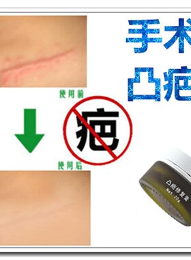 消去儿童脸部增生性刀疤印烧烫伤疤痕灵修复贴祛除手术凹凸起疙瘩