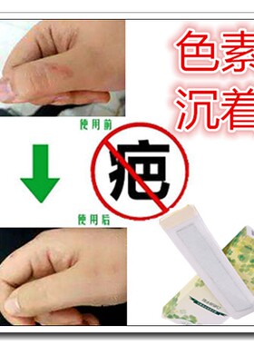 祛痘疤痕灵凹凸疤修复剂软化针缝防疤停去脸部刀伤疤膏褪黑色素片