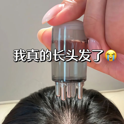 头皮米诺上药器滚珠按摩梳涂抹器