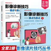 专家教你快速掌握影像读片技巧 社 要点与盲点1 影像诊断 读片技巧 全套2册 影像诊断技巧 北京科学技术出版 正版 影像解剖 包邮