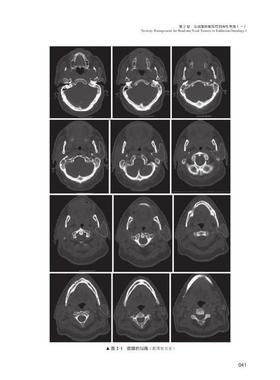 放射学急与晚期毒的:放射学中的毒管理:management of toxicities in radiation oncology  医药卫生书籍