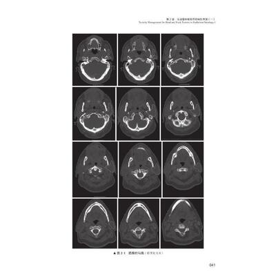 放射学急与晚期毒的:放射学中的毒管理:management of toxicities in radiation oncology  医药卫生书籍